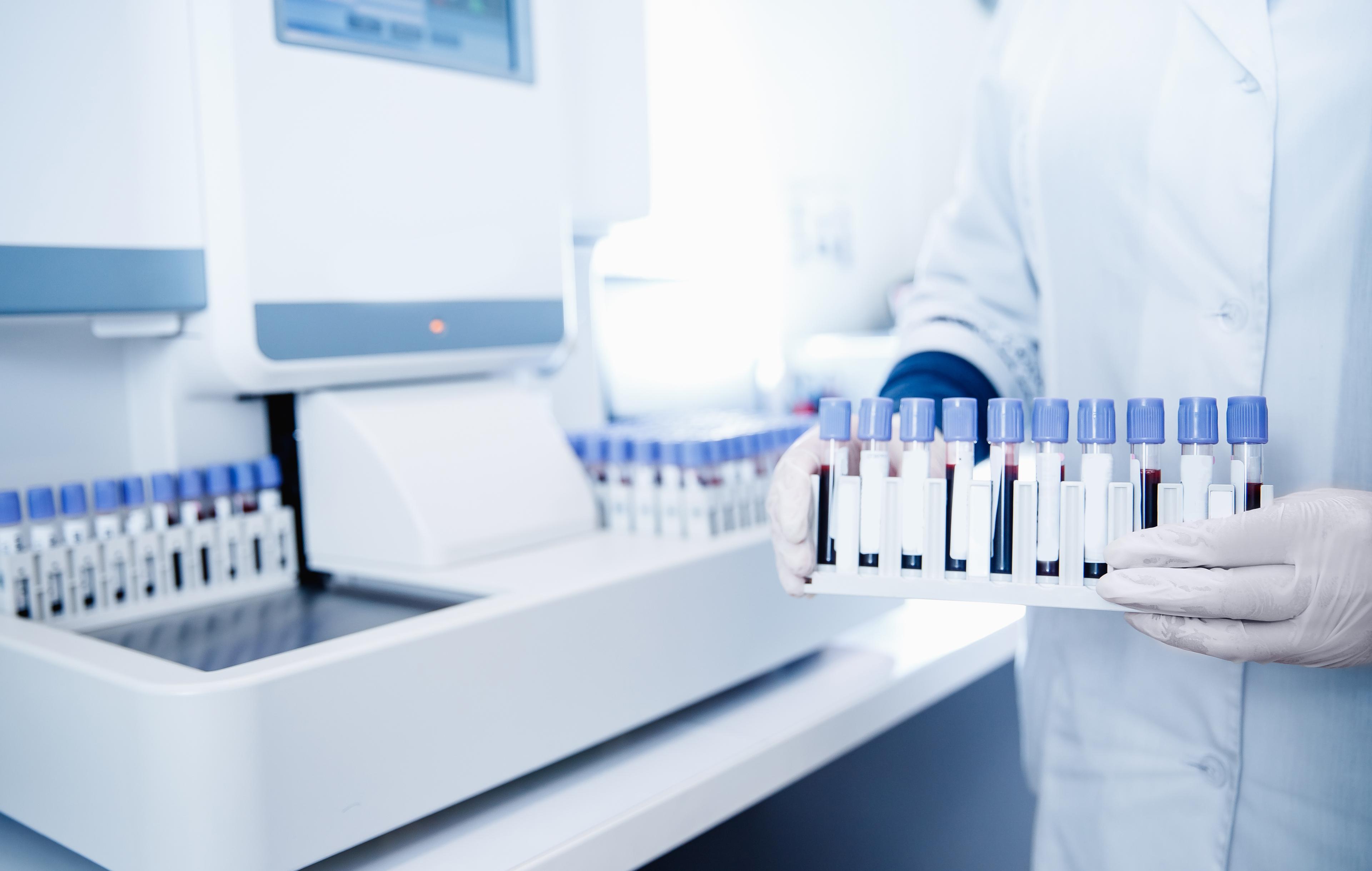 In-vitro diagnostics